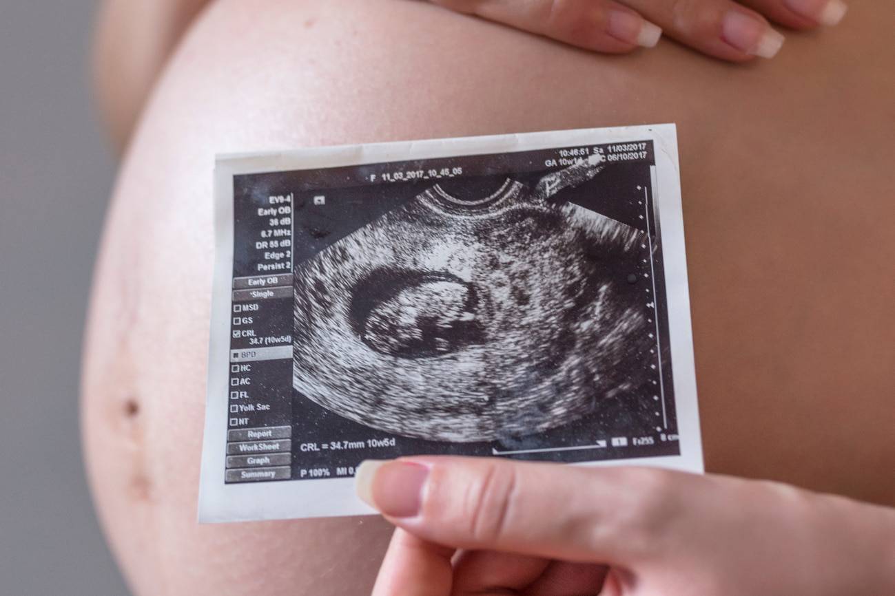 Relacionan la contaminación del aire con cambios en el desarrollo cerebral fetal