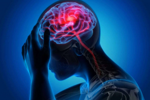 El ictus cerebral mata las neuronas mediante ondas eléctricas letales