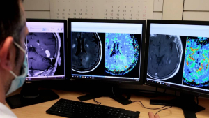 Nueva herramienta basada en la IA mejorará el diagnóstico de cáncer cerebral